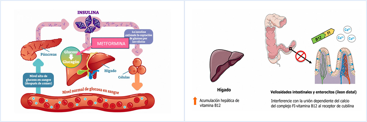 Mecanismos propuestos de la reducción de vitamina B12 asociados al uso prolongado de metformina.