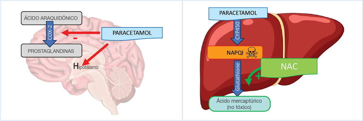 Metabolismo del paracetamol y papel del glutatión en la neutralización de metabolitos reactivos.